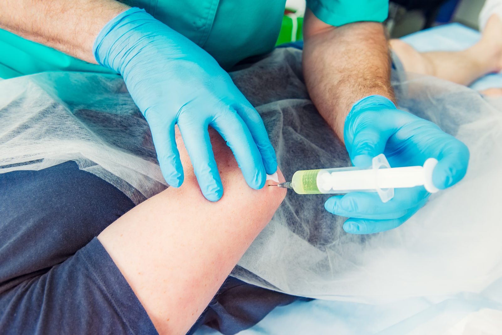 Clinician wearing sterile gloves administering an injection into a knee joint through a sterile drape
